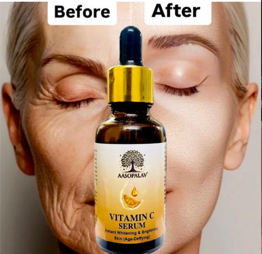 Aasopalav Vitamin C serum